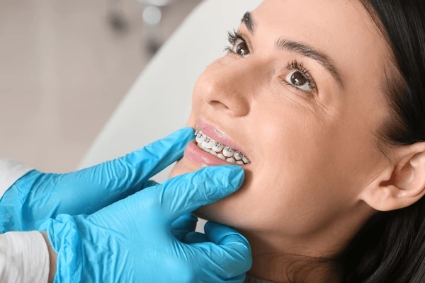 braces near you