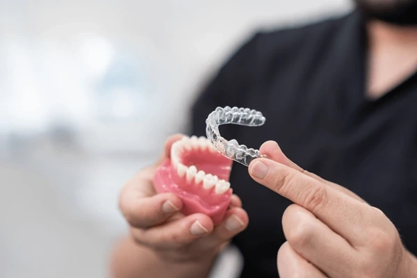 clear aligners in kamloops, bc