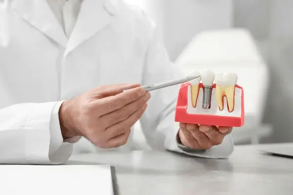 dental implants in kamloops, bc