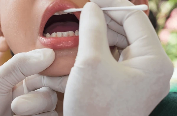 fluoride treatments in kamloops, bc