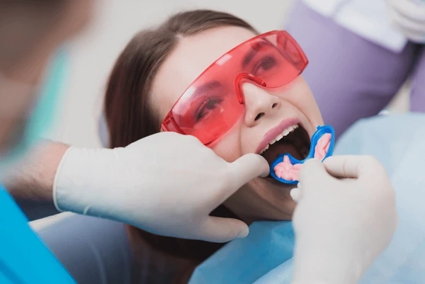 fluoride treatments near you