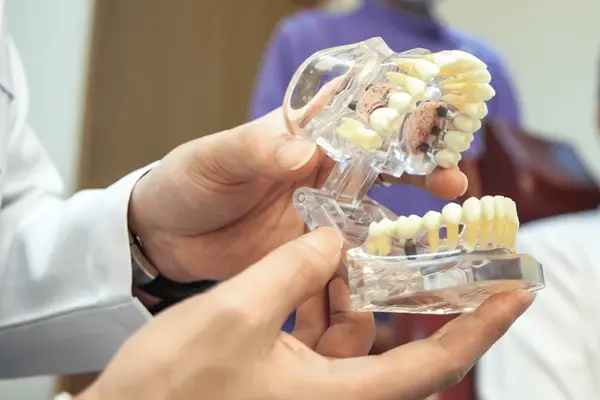 full mouth restorations in kamloops, bc