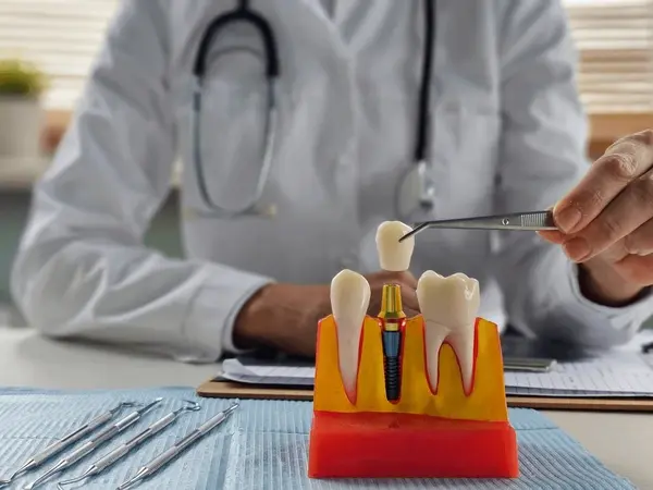 single dental implants near you