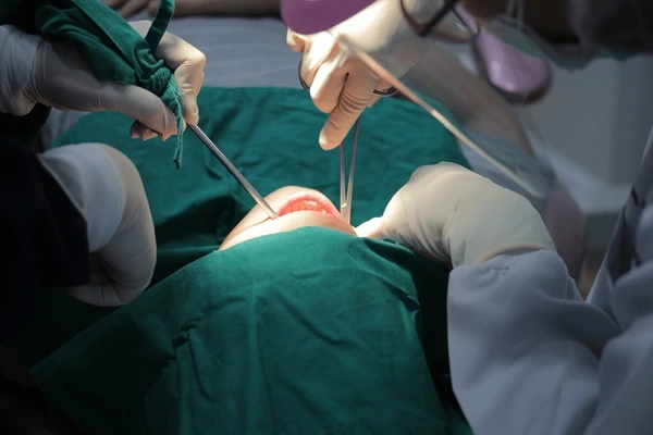 teeth extraction in kamloops, bc