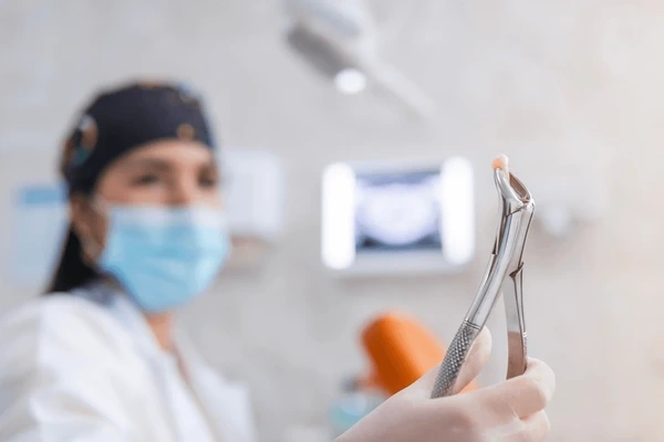tooth extractions in kamloops, bc
